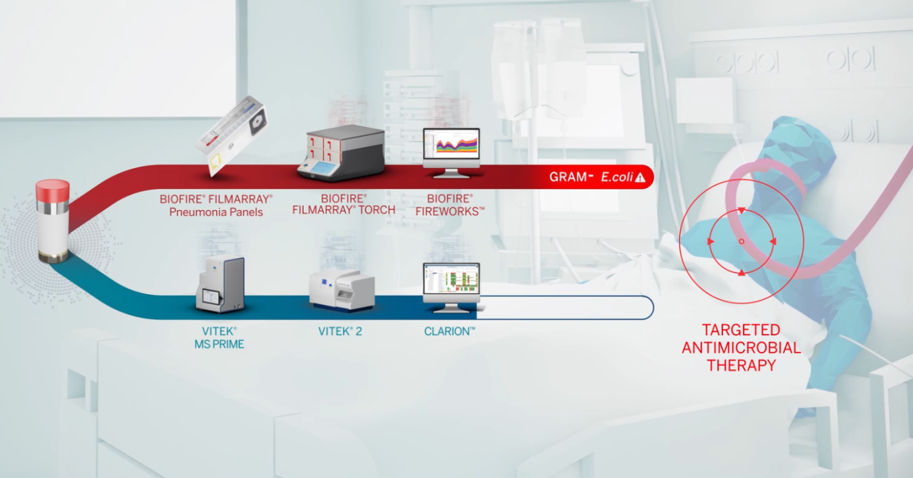 Coinfecções respiratórias da COVID-19