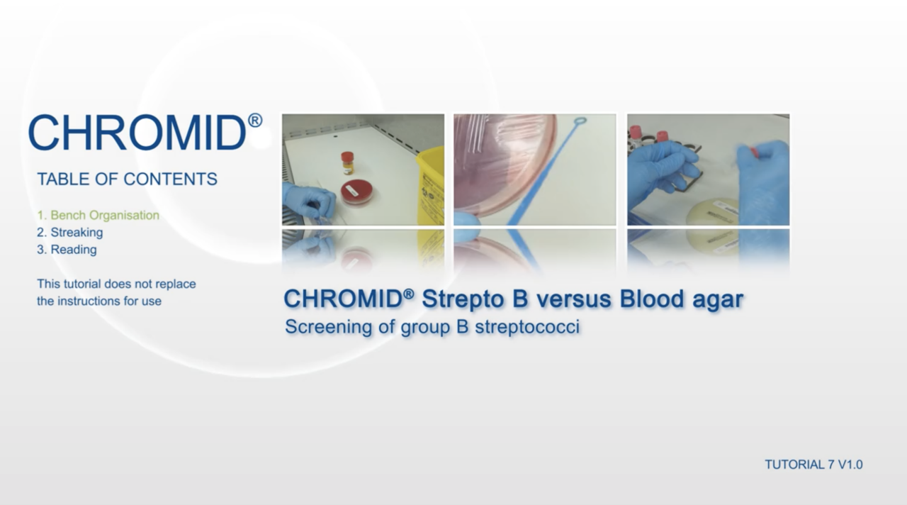 Tutorial em vídeo do CHROMID® Strepto B