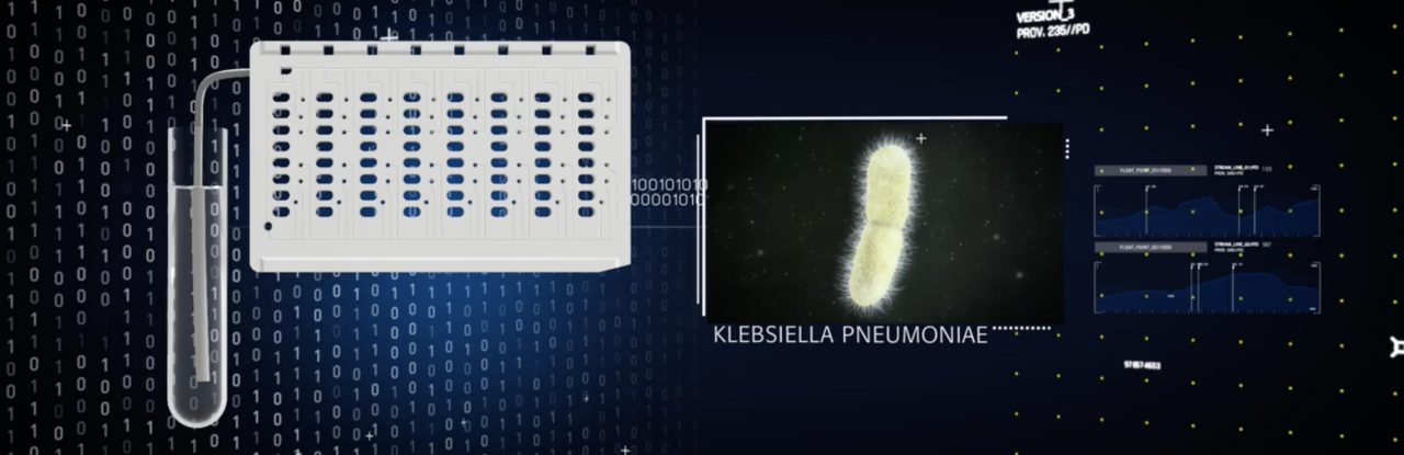 Tratamento imersivo de ITUs por vídeo