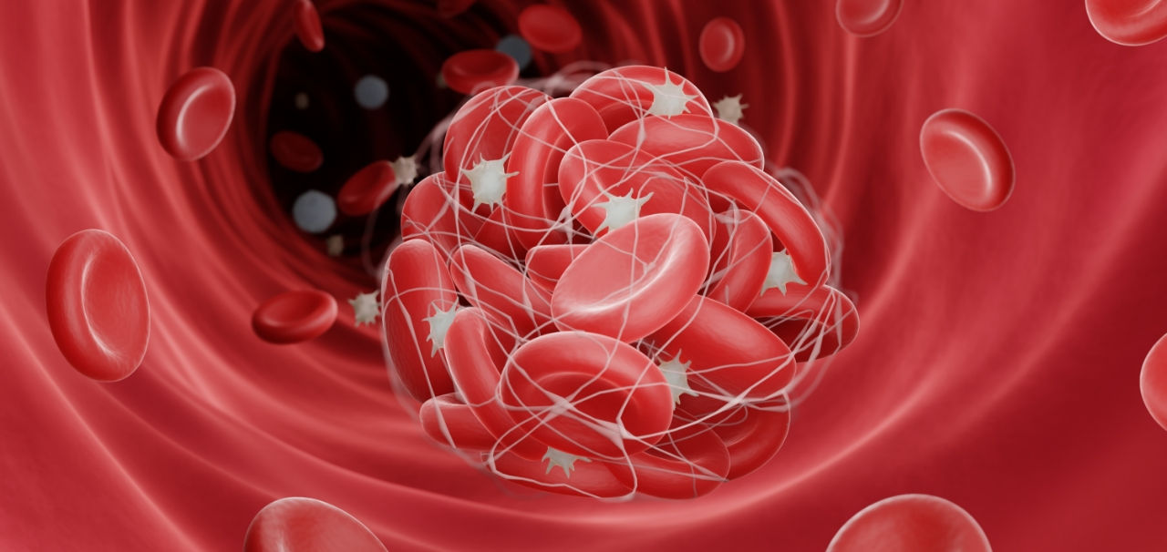 Thrombosis & Coagulation Testing & Biomarkers