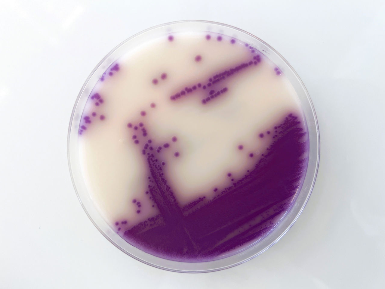ASAP™ | Pioneering Diagnostics