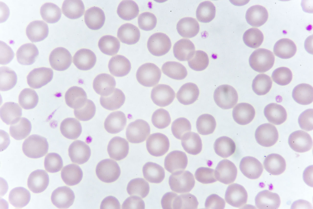 Platelet Bacterial Contamination Screening Pioneering Diagnostics