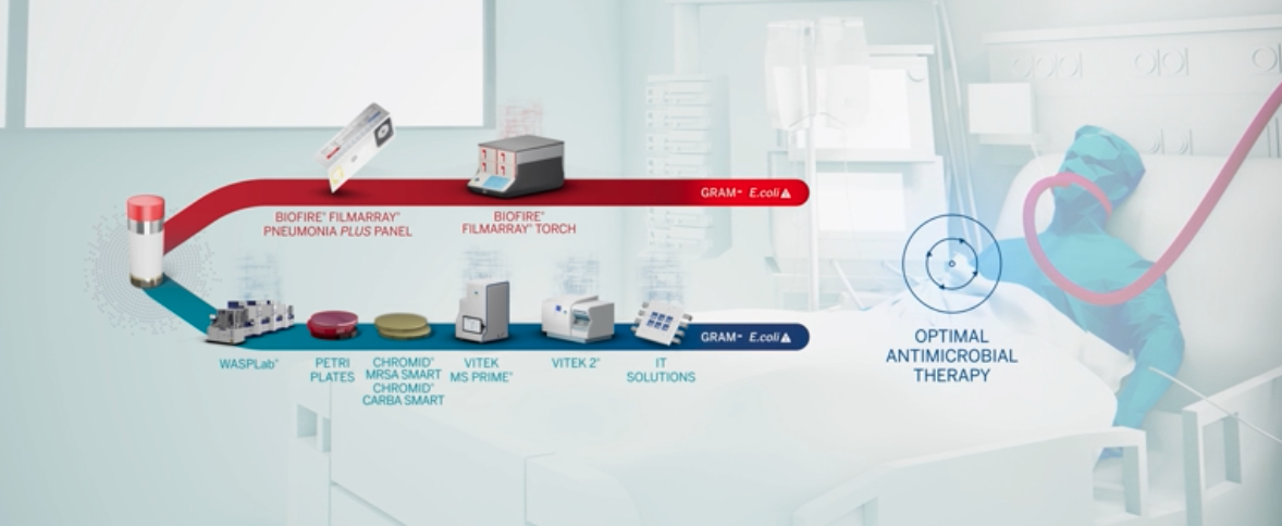 COVID-19 Respiratory Co-Infections