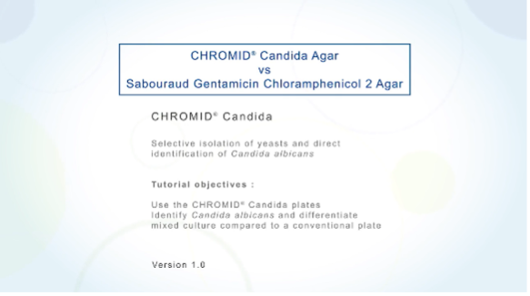 Tutorial de CHROMID® Candida Agar frente a Sabouraud Gentamicin Chloramphenicol 2 Agar