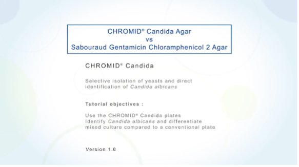 CHROMID® Candida Agar Vs. Sabouraud Gentamicin Chloramphenicol 2 Agar Tutorial