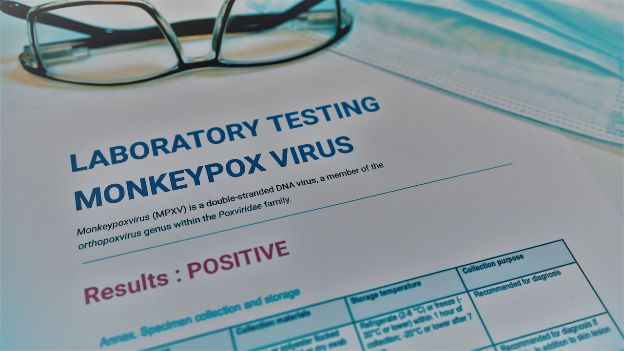 Monkeypox testing