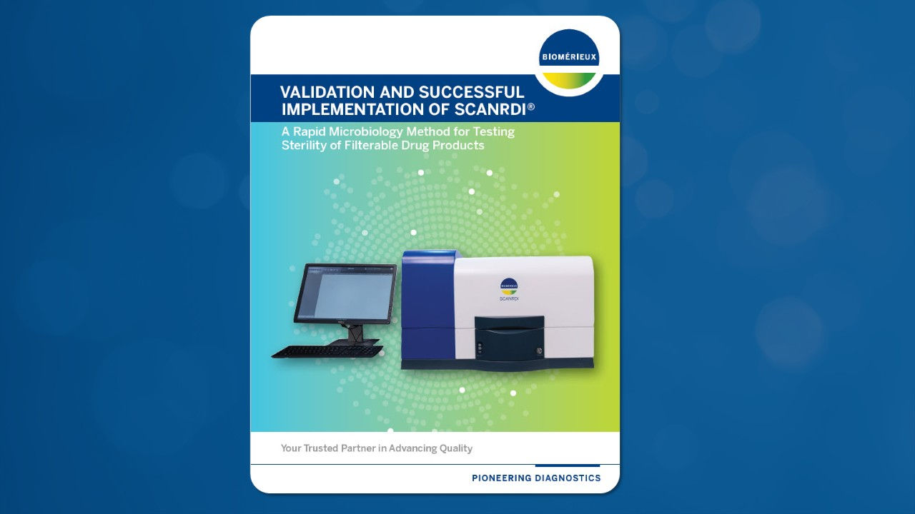 Validation and Successful Implementation of SCANRDI