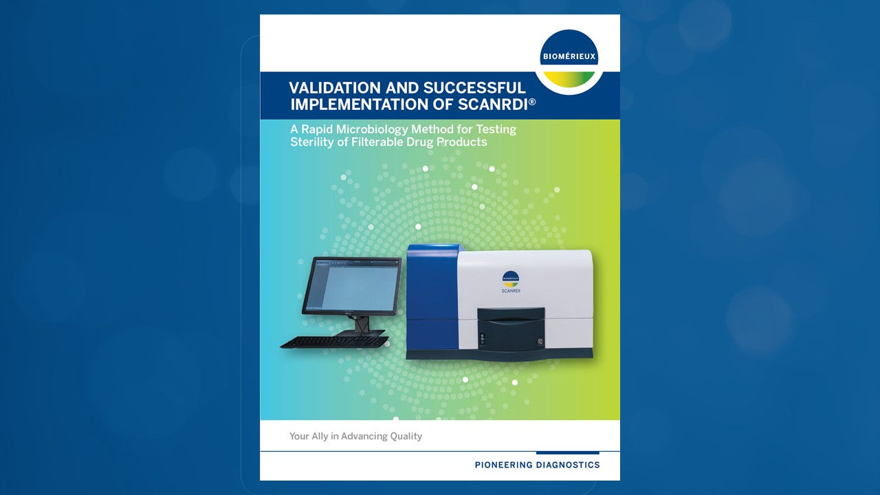 Validation and Successful Implementation of SCANRDI