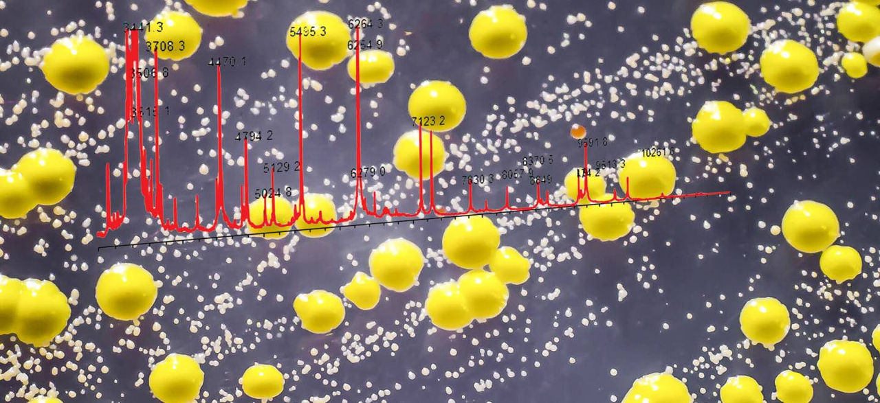 Identification of Pharmaceutical Environmental Microorganisms